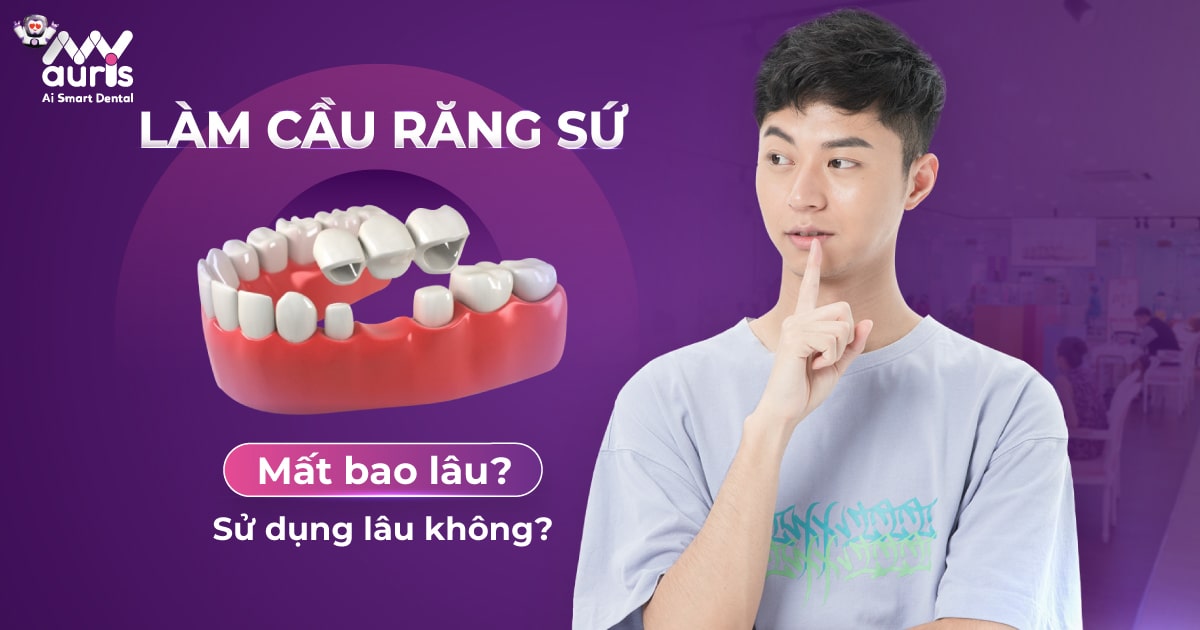 Làm cầu răng sứ mất bao lâu