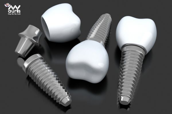 Công nghệ xử lý vùng cổ trụ implant - Sự khác nhau giữa các loại trụ implant là gì? 