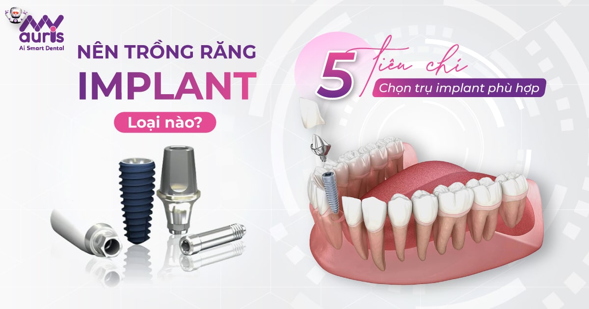 Nên trồng răng implant loại nào