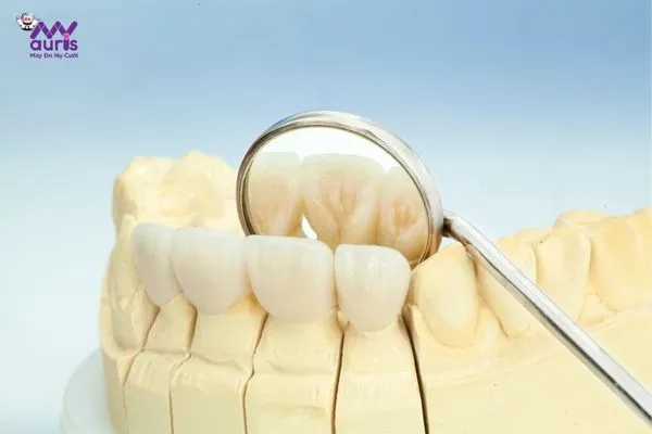 Các trường hợp cụ thể cho từng phương pháp - nên trồng răng sứ hay bọc răng sứ 