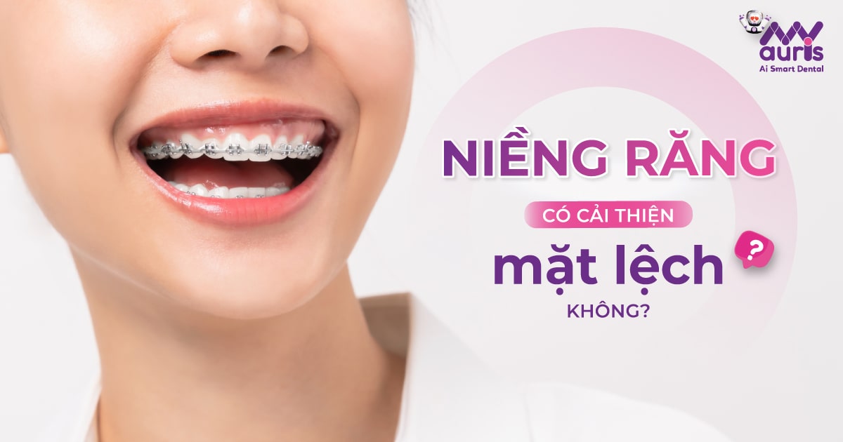 [Tư vấn] Niềng răng có cải thiện mặt lệch không?