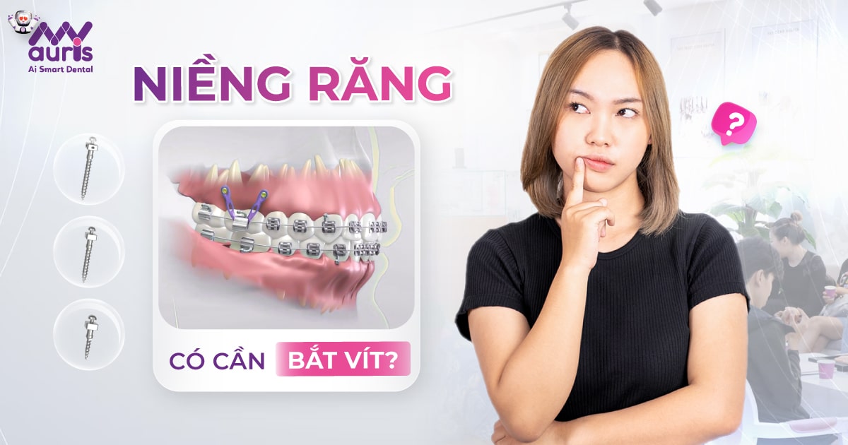 Niềng răng có cần bắt vít? - 5 trường hợp nên thực hiện