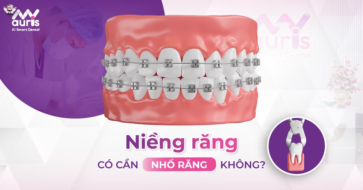 Niềng răng có cần nhổ không? (Cụ thể 2 trường hợp)