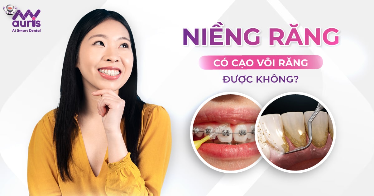 Niềng răng có cạo vôi răng được không? (3 lợi ích cần biết)