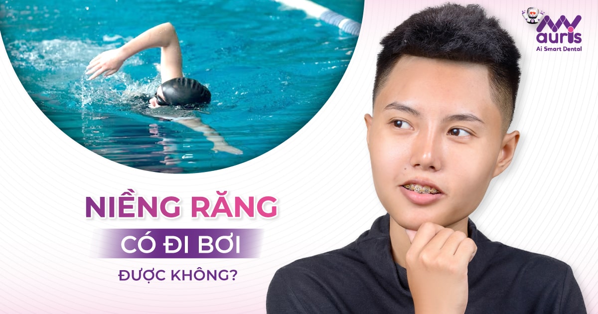 [Giải đáp] Niềng răng có đi bơi được không?