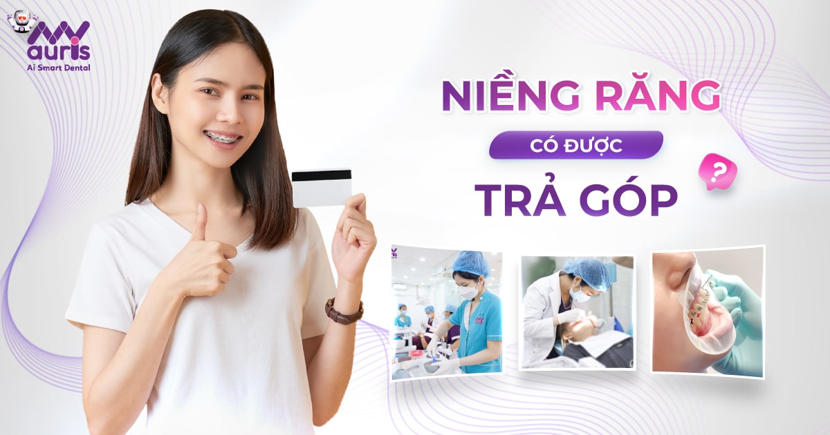 Niềng răng có được trả góp không? 4 lưu ý cần nhớ