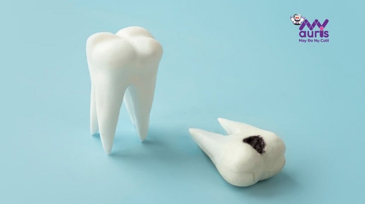 niềng răng có hại gì cho sức khỏe không