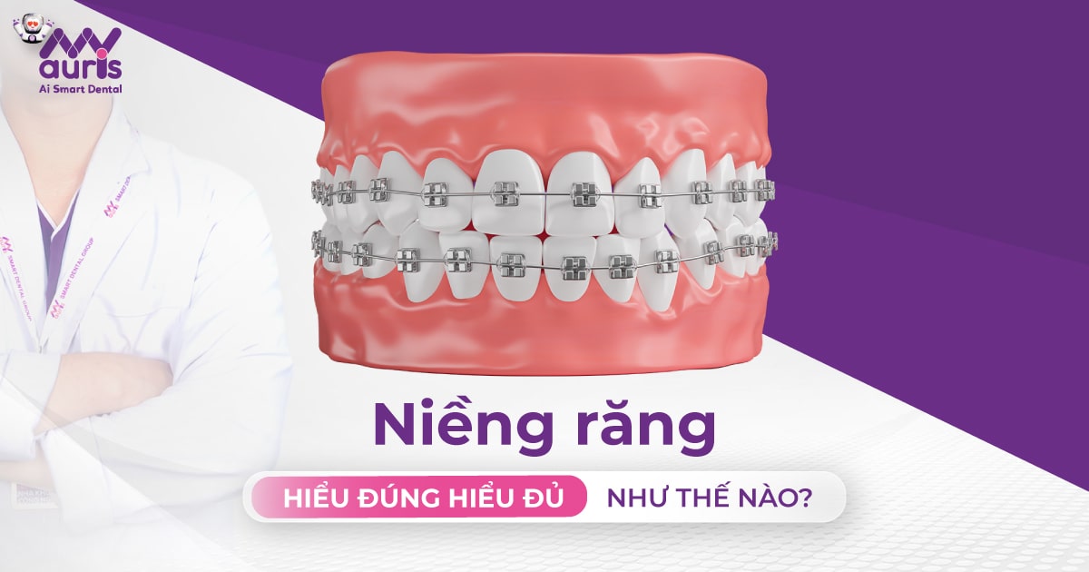 Niềng răng hiểu đúng hiểu đủ như thế nào?