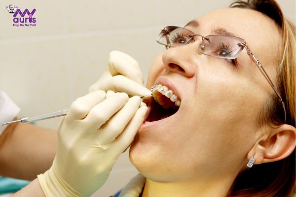 Niềng răng khớp cắn hở - Điều trị giai đoạn khớp cắn hở hình thành
