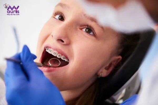 Các phương pháp niềng răng ở trẻ em 