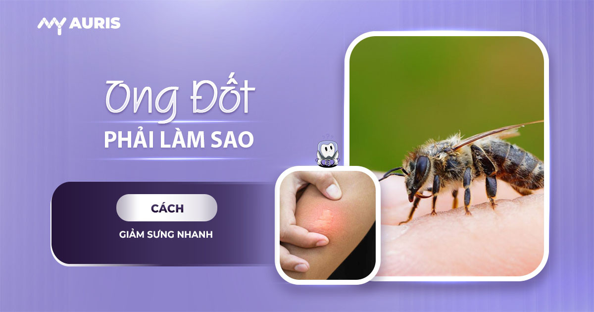bị ong đốt phải làm gì,vết ong đốt,trị ong đốt
