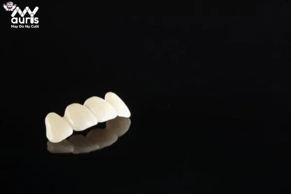 Giải đáp răng sứ Cercon sử dụng bảo hành được bao lâu?