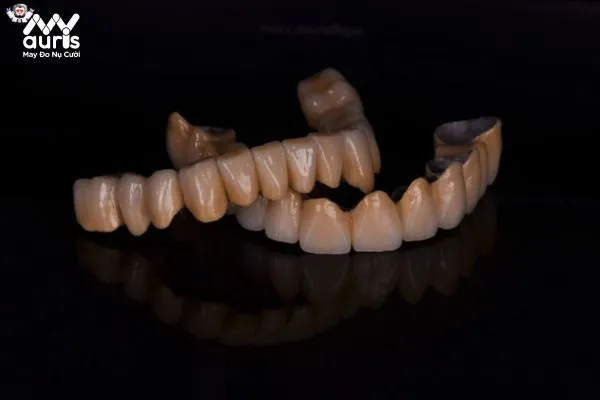 Giải đáp răng sứ Titan có tốt không từ các bác sĩ chuyên môn