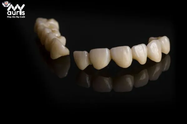 Một số nhược điểm của dòng răng sứ Titan
