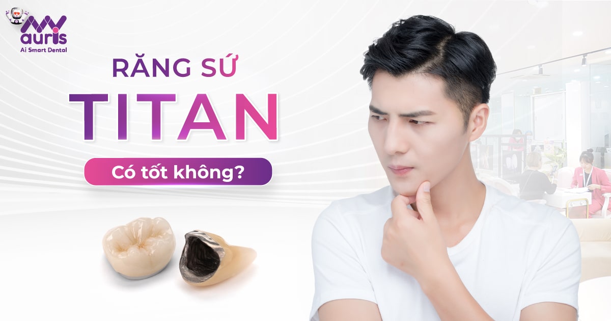 Răng sứ Titan có tốt không? (Tham khảo qua ưu nhược điểm)