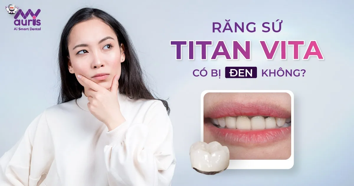 Răng sứ Titan Vita có bị đen không? (4 yếu tố ảnh hưởng)