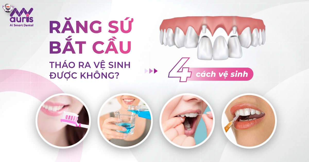 Răng sứ bắt cầu tháo ra vệ sinh được không