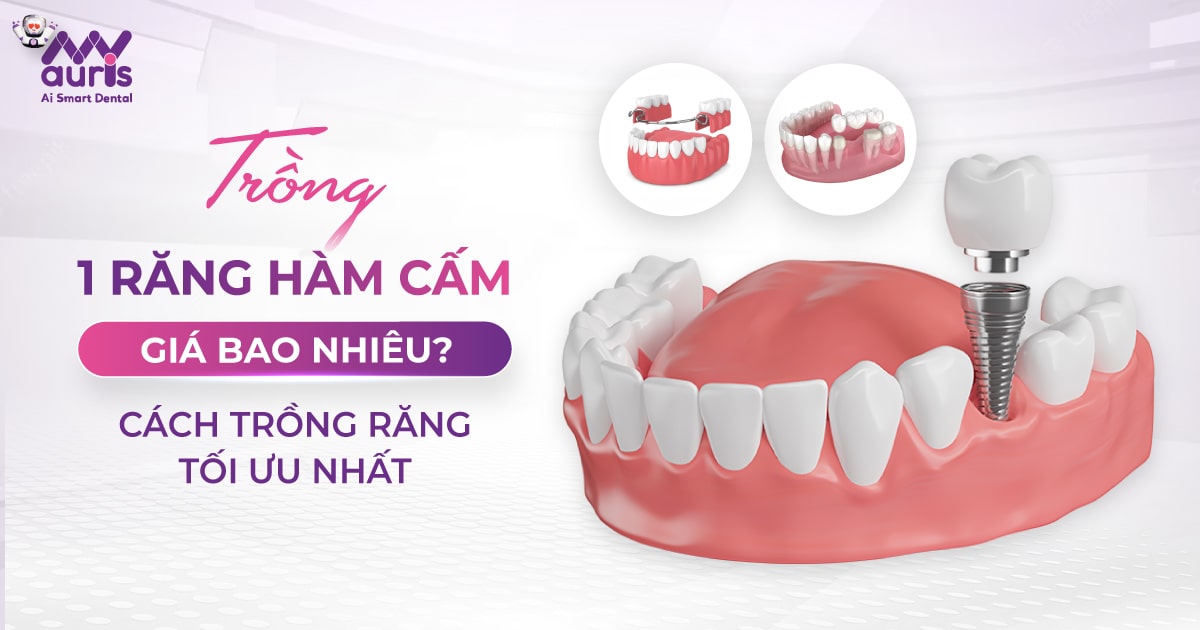 Trồng 1 răng hàm cấm giá bao nhiêu