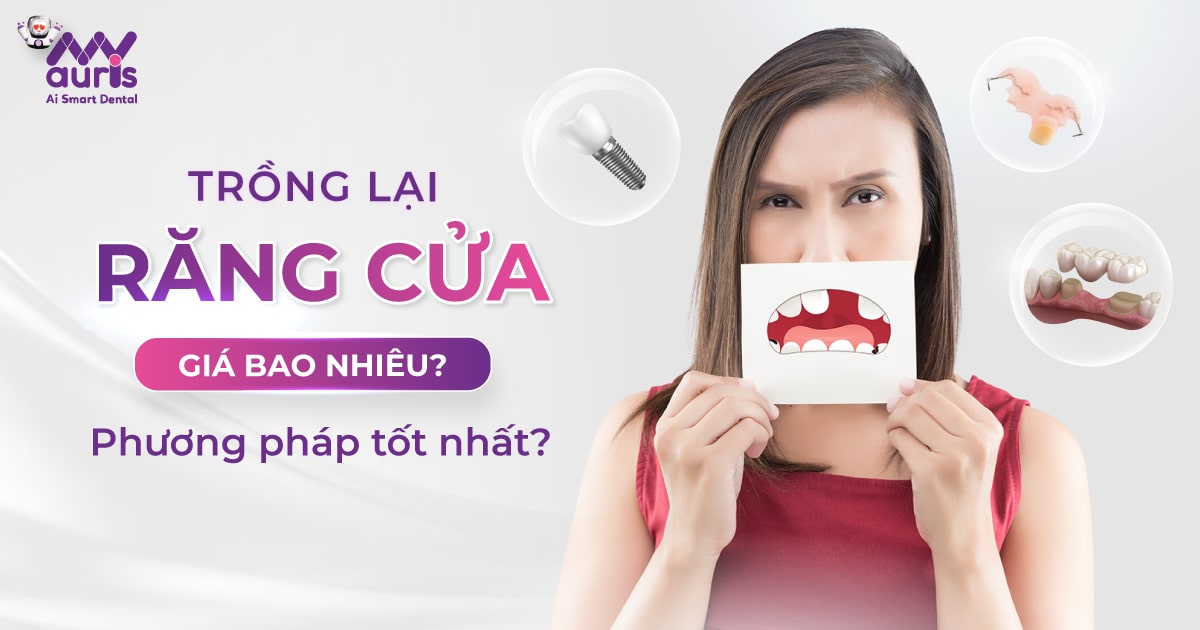 Trồng lại răng cửa giá bao nhiêu