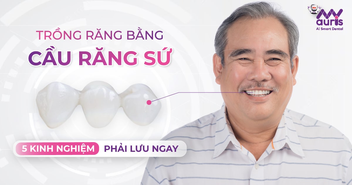 Trồng răng bằng cầu răng sứ