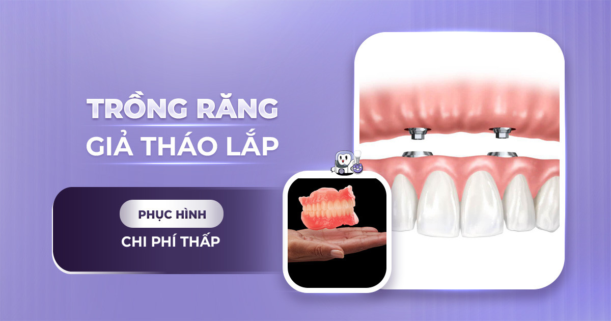 trồng răng giả tháo lắp,làm răng giả tháo lắp