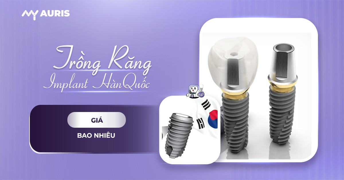 Trồng răng implant Hàn Quốc Giá bao nhiêu