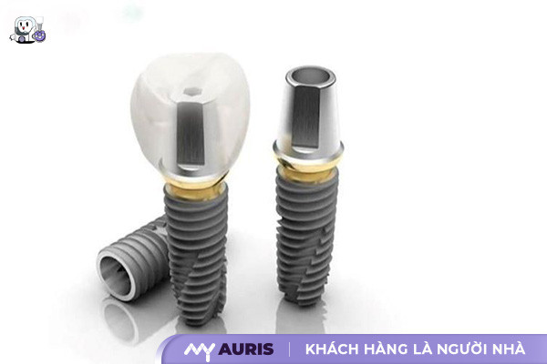 trong-rang-implant-han-quoc-gia-bao-nhieu-091224-02