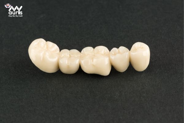Ưu nhược điểm của răng sứ cercon ht 