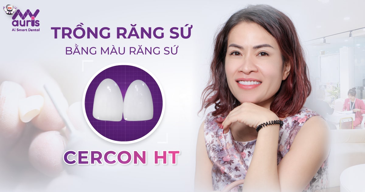 Trồng răng sứ bằng màu răng sứ cercon ht