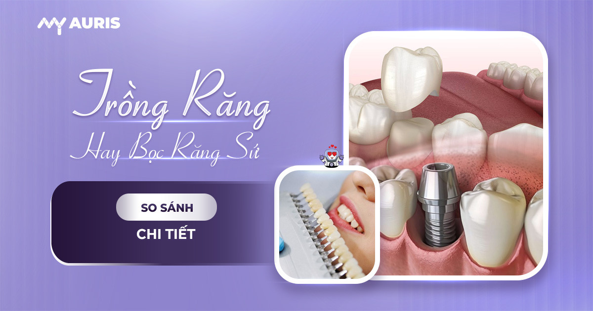 bọc răng sứ và trồng răng sứ,có nên bọc răng sứ hay không,nên trồng răng sứ hay bọc răng sứ