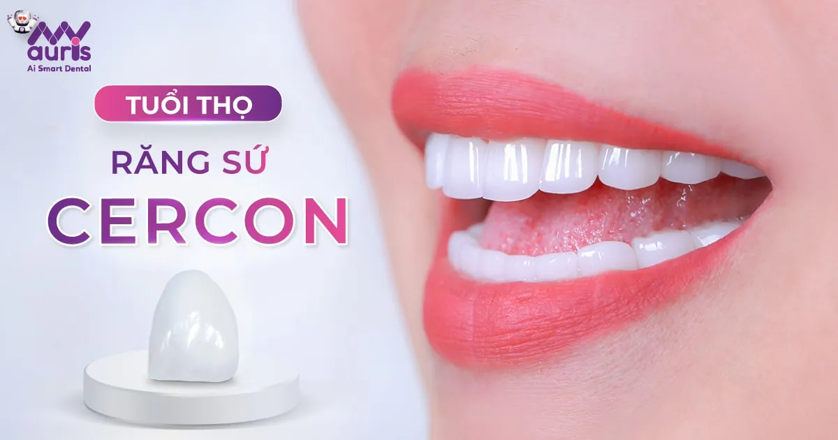 Tuổi thọ của răng sứ Cercon - 5 yếu tố ảnh hưởng