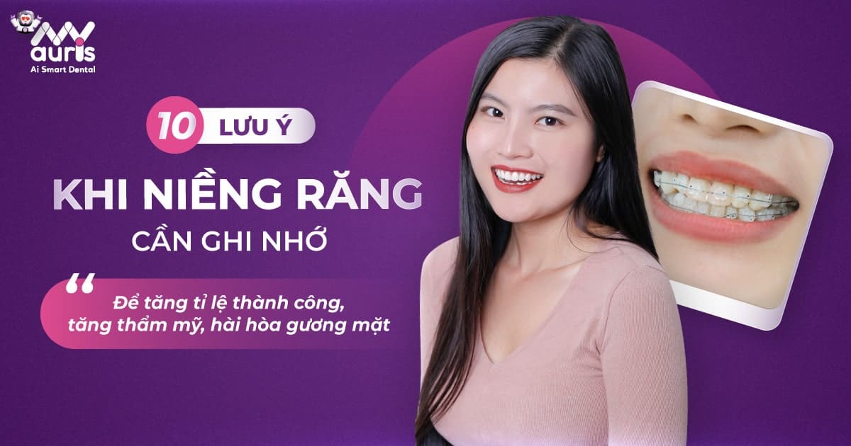 10 Lưu ý khi niềng răng cần ghi nhớ