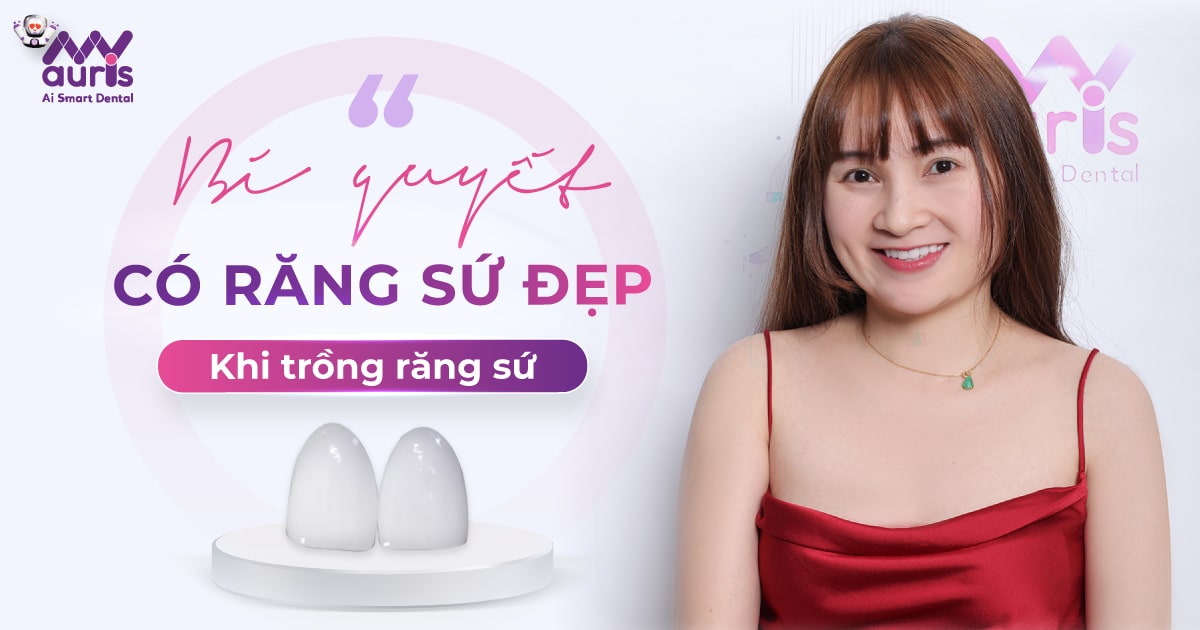 kinh nghiệm trồng răng sứ