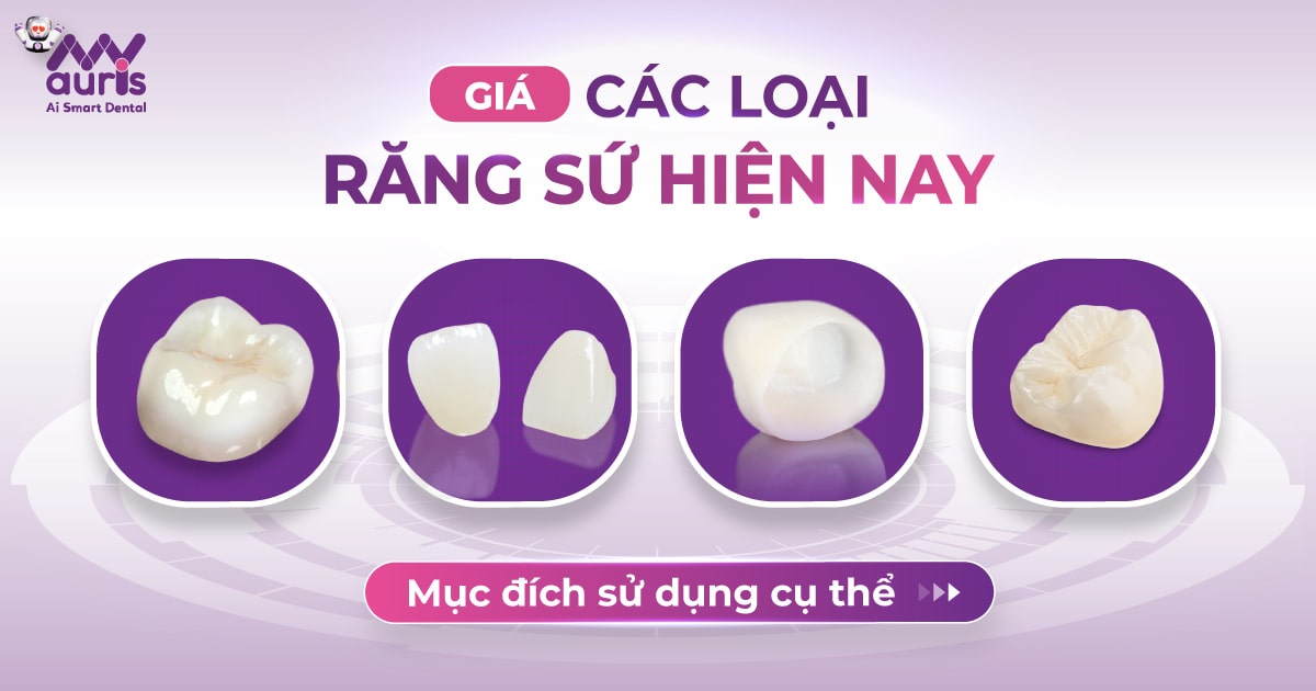 giá các loại răng sứ hiện nay