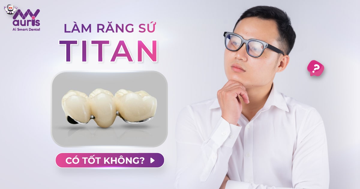 răng sứ kim loại ceramco iii