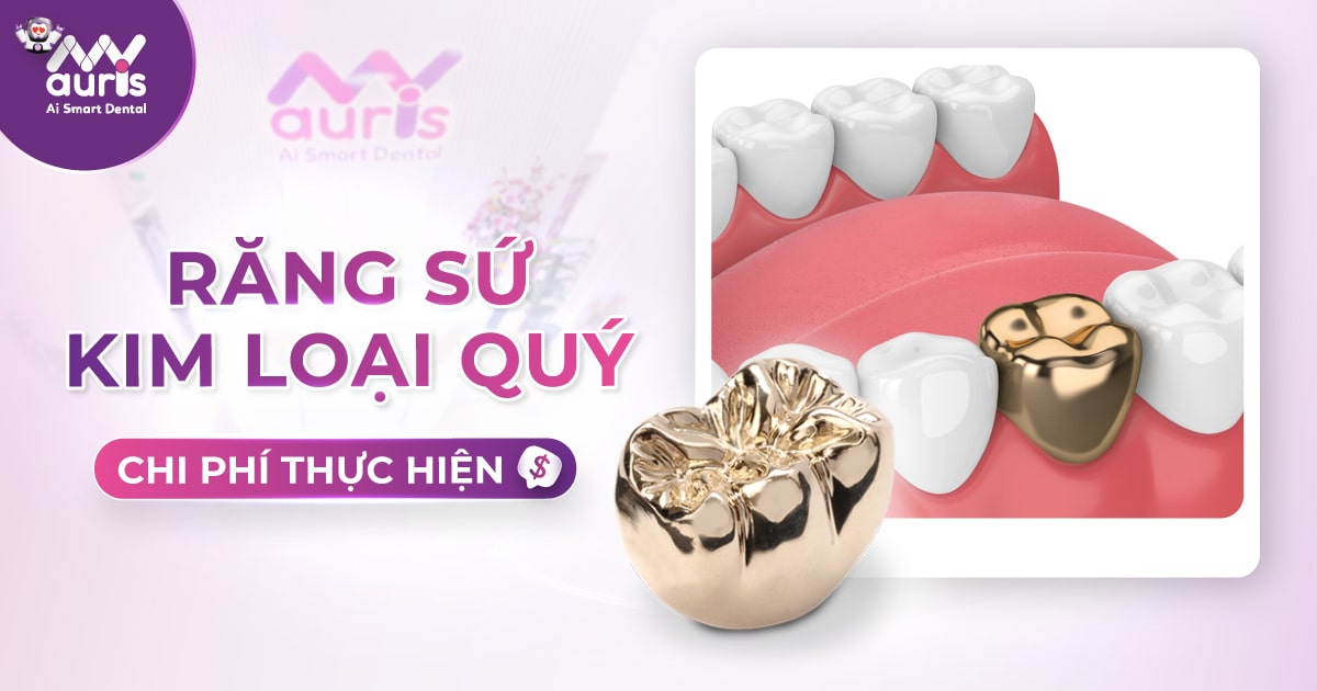 răng sứ kim loại quý