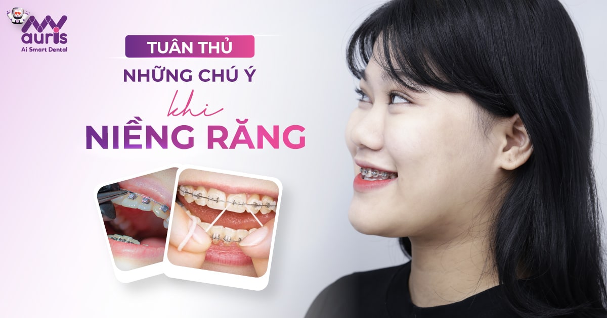 những lưu ý khi niềng răng