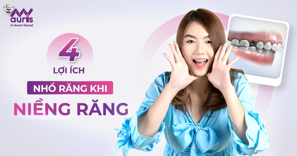 nhổ răng khôn khi niềng răng