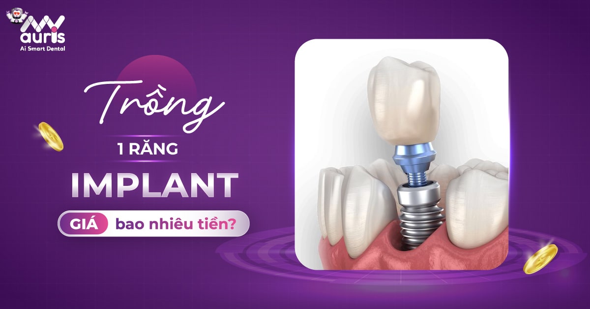 trồng 1 răng implant giá bao nhiêu