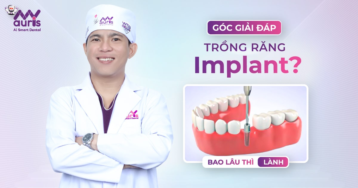 trồng răng implant bao lâu thì lành