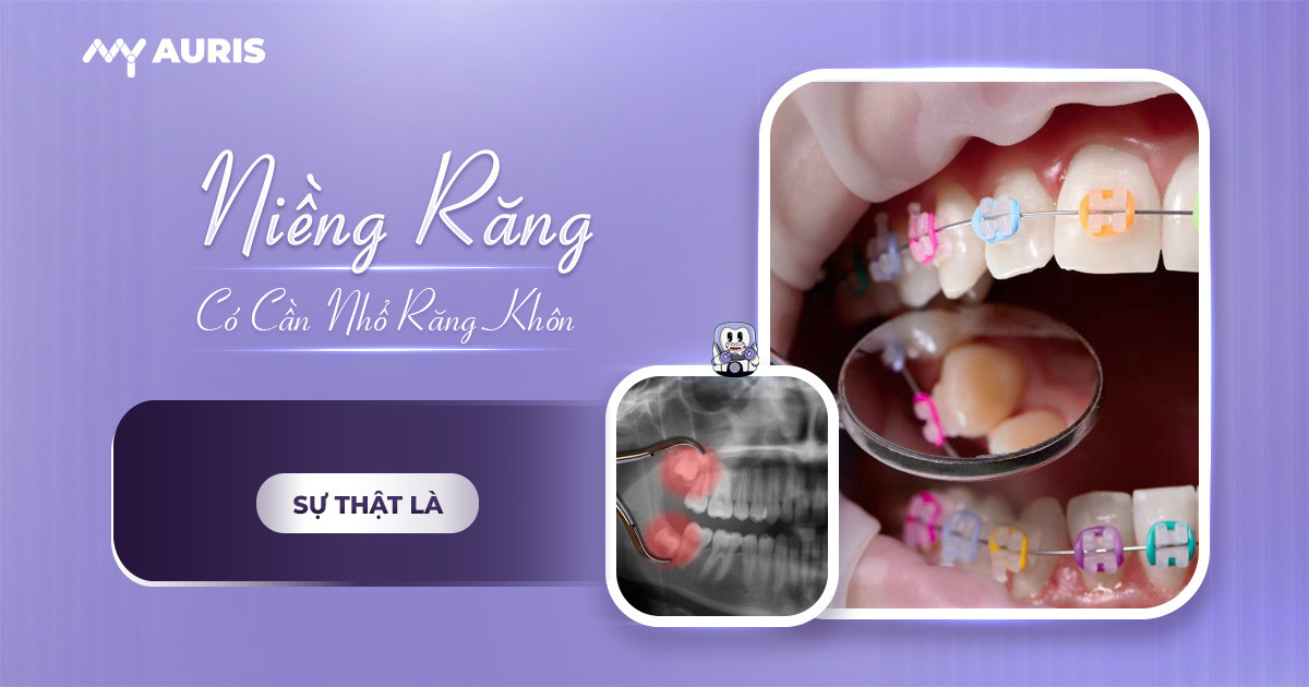 niềng răng có cần nhổ răng khôn không