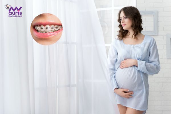 Mang thai có niềng răng được không? 