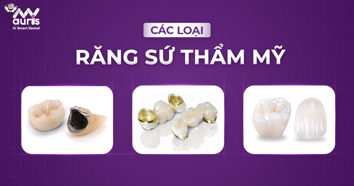 Các loại răng sứ thẩm mỹ - 5 loại phổ biến lựa chọn