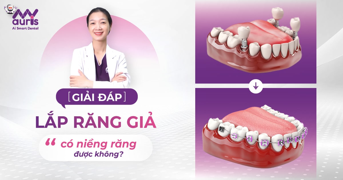 [GIẢI ĐÁP] Lắp răng giả có niềng răng được không?