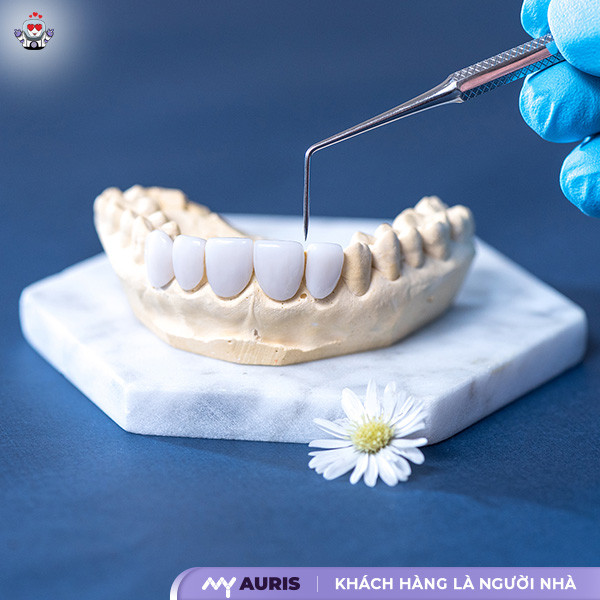 bọc răng sứ,làm răng sứ,công nghệ bọc răng sứ,công nghệ làm răng sứ,công nghệ răng sứ