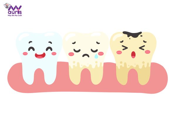 Mắc bệnh lý răng miệng mà không được điều trị trước khi làm răng sứ 