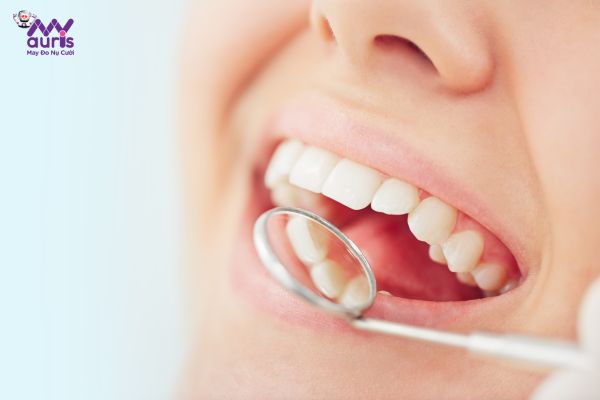 Tái khám định kỳ - Phương pháp phòng ngừa làm răng sứ bị hôi miệng 