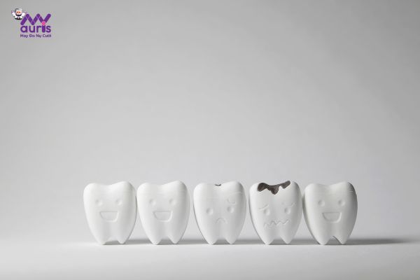Răng sâu - Trường hợp nên làm răng sứ 