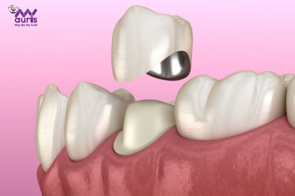 Làm răng sứ sau khi lấy tủy có những lợi ích gì? 