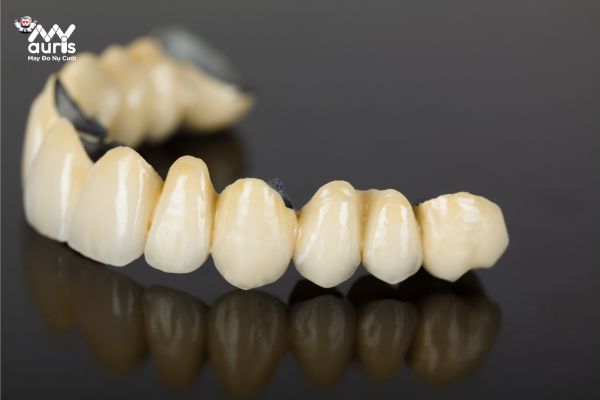 Răng sứ kim loại mỹ
